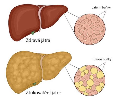 Štruktúra pečene a ukladanie tuku