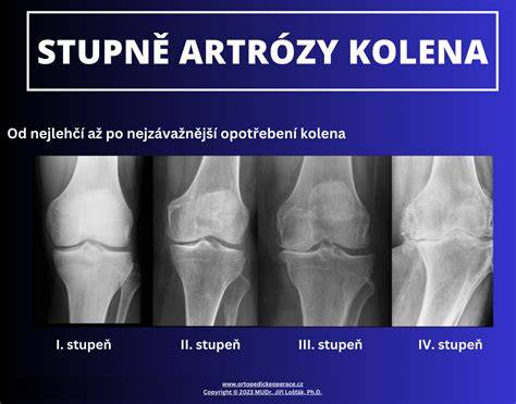 Infografika: Postup pečenia bravčového kolena po nemecky