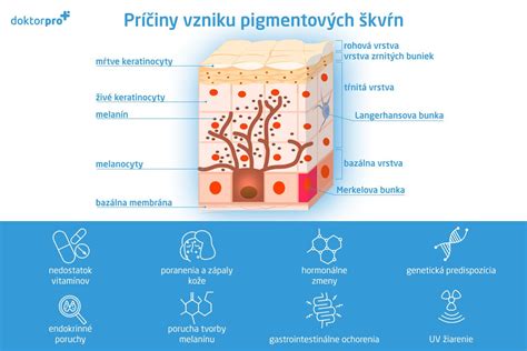 Príčiny vzniku trhlín v betóne