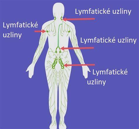 Infografika: Lymfatický systém, uzliny a ich filtračné funkcie