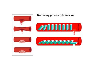 Ilustrácia procesu zrážania krvi