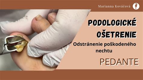Štruktúra zdravého a poškodeného nechtu