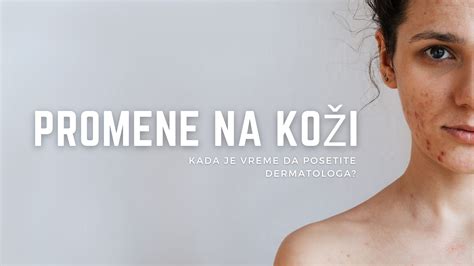 Infografika: Základné kroky na prípravu rýb na koži a tipy na šťavnatosť
