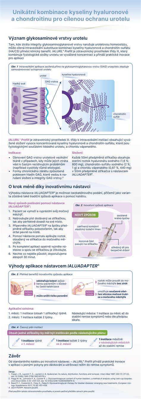 Infografika: Pravidlá náhrad kyseliny citrónovej v segedínskom guláši