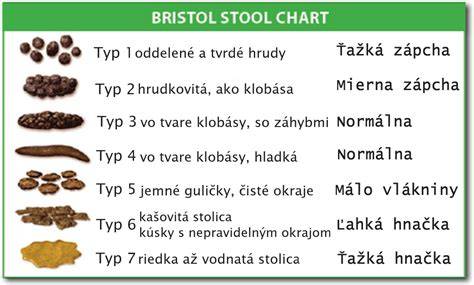 Infografika: 7 typov stolice podľa Bristolovej škály a čo znamenajú
