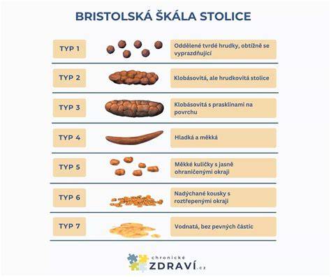 Brisljnská stupnica stolice - 7 typov