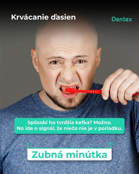 Ilustrácia príznakov zápalu ďasien