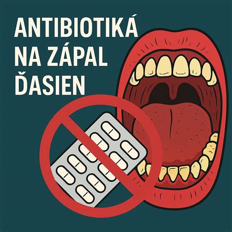 Balenie liekov na zápal ďasien