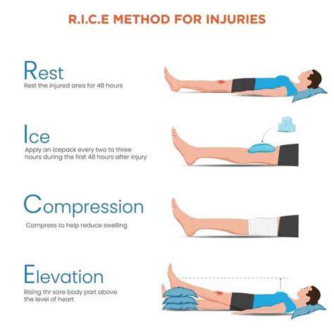 Infografika: RICE protokol (Rest, Ice, Compression, Elevation) pre prvú pomoc