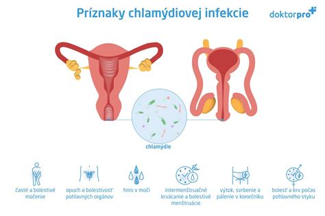 schéma diagnostiky chlamýdiovej infekcie
