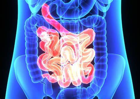 Infografika: putovanie potravín FODMAP cez tenké a hrubé črevo