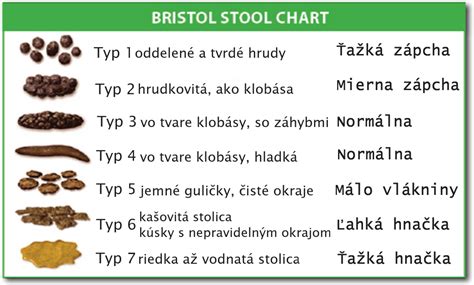 Infografika: Príčiny zápachu stolice a rozdelenie podľa typov stolice