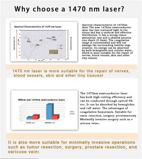 Infografika: princíp pôsobenia Laser Intimee® (vlnové dĺžky 1470 nm a 980 nm)