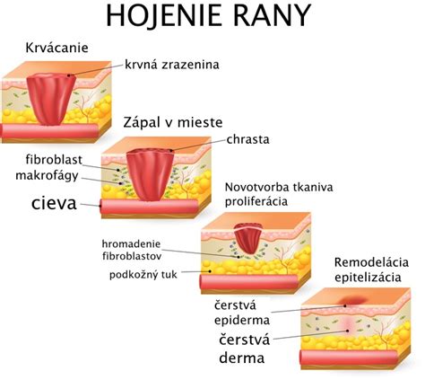 Infografika: Fázy hojenia rán a trvanie jednotlivých fáz