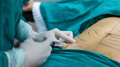 Infografika: Rozdelenie plastickej chirurgie na kozmetickú, rekonštrukčnú a onkologickú