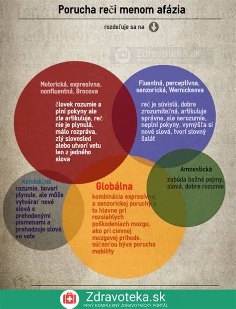 Infografika: Rozdelenie štýlov rumov a ich charakteristík