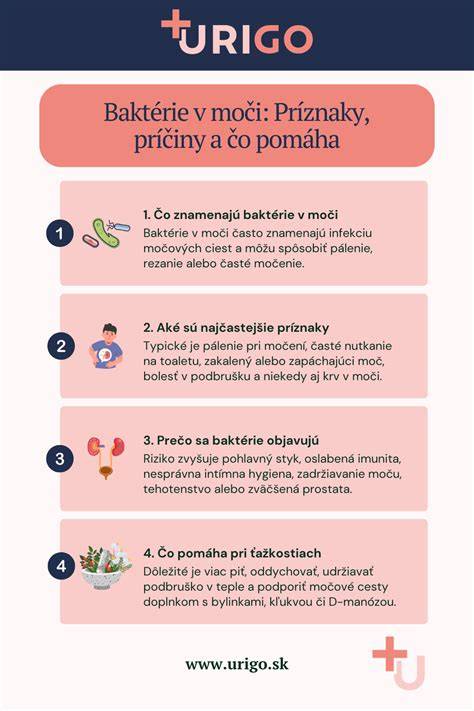 Infografika: Postup francúzskej manikúry krok za krokom