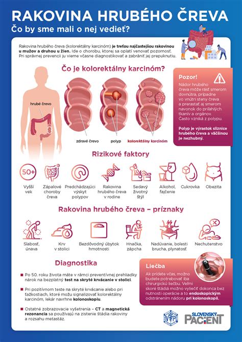 Infografika: Plnenie čreva a zviazanie jaternice