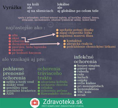 Infografika: Spôsob vzniku pálenia záhy a LES