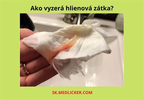 Infografika: Ako vyzerá hlienová zátka, rozdiely s plodovou vodou a bežný vaginálny výtok