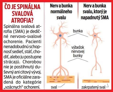 Infografika: Dna a kyselina močová, čo je purín a kde vzniká