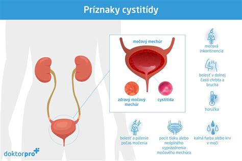 anatómia močových ciest ženy a muža