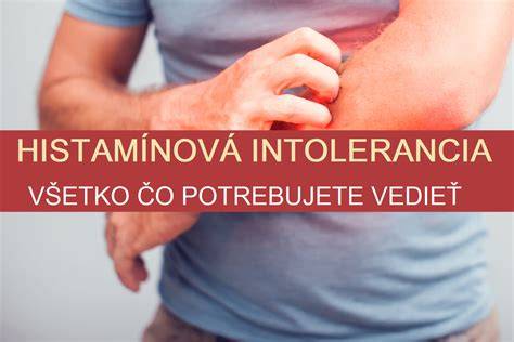 Graf: Zoznam potravín bohatých na histamín a potravín, ktoré uvoľňujú histamín