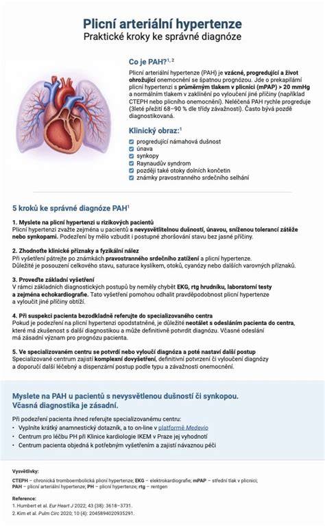 infografika: kroky výroby karamelového sirupu